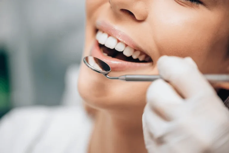 Fillings